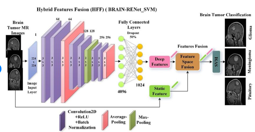 Brain Tumor Image Classification Using CNN